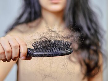 Hair loss or balding in women solution