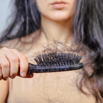 Haarverlies of kaal worden bij vrouwen oplossing Haarverlies of kaal worden bij vrouwen oplossing